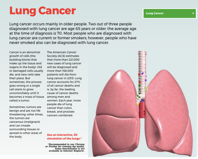 Learning About Lung Cancer Best Online Resources For Patients The